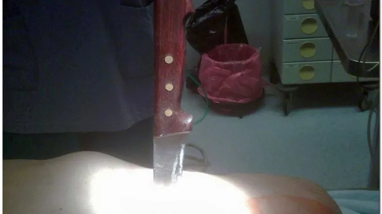 Starac poku&scaron;ao ubiti cimera zbog SP-a