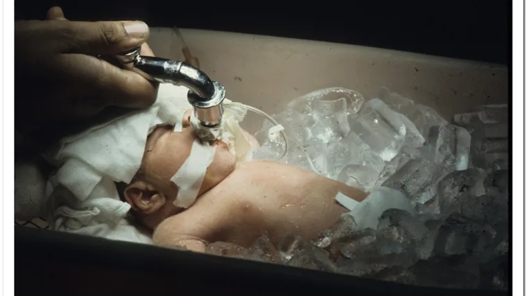 Zbog problema sa srcem dječaka smrznuli na četiri dana