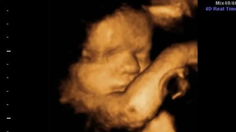 Tko abortira dobit će otkaz