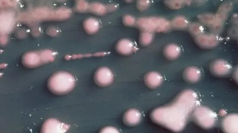 Prva žrtva superbakterije