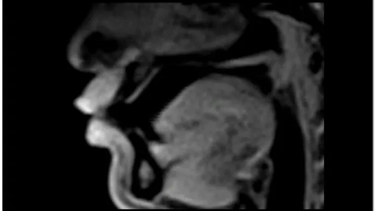 Prve snimke organa u realnom vremenu