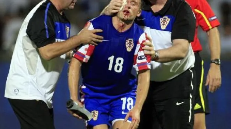 Ivici Oliću slomio nos
