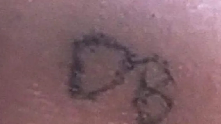 Žiletom tetovirao trogodi&scaron;njeg sina