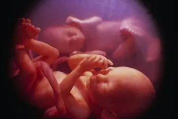 Presađuju joj majčinu maternicu