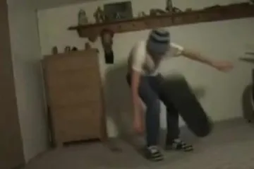 Skateboard mu slomio nos