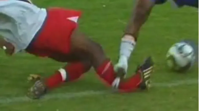 Izvedena prva transplantacija nogu na svijetu