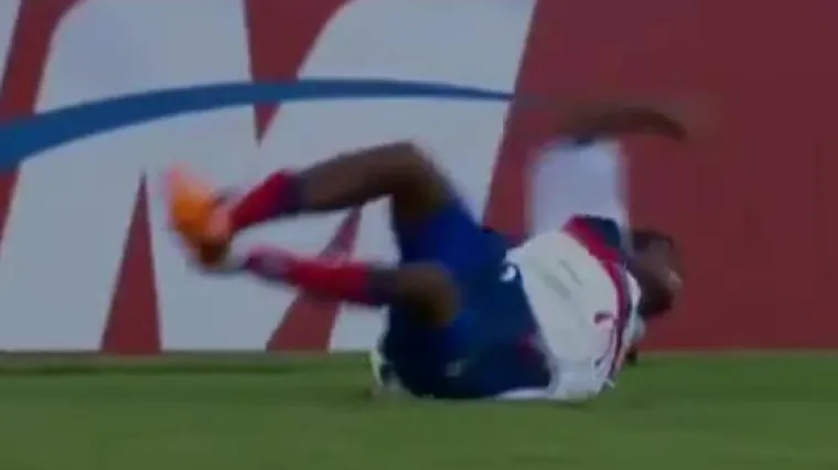 VIDEO: Poku&scaron;ao impresionirati pa zavr&scaron;io sa slomljenom rukom