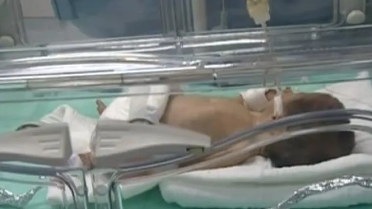 Novorođenče u te&scaron;koj borbi za život