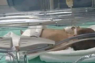 Novorođenče u teškoj borbi za život