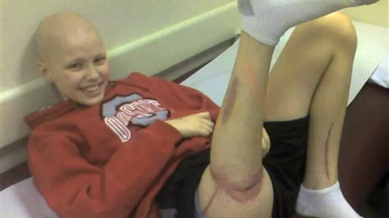 Dječaku amputirali nogu i pri&scaron;ili je naopako