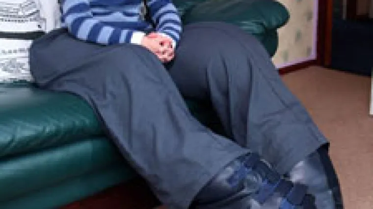 Presretna jer su joj amputirali nogu