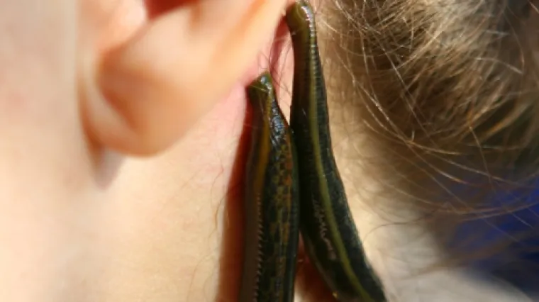 Pas joj odgrizao pola lica, pijavice ga uspjele vratiti