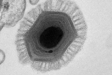 Otkriven najveći virus u povijesti čovječanstva