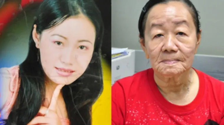 U nekoliko mjeseci ostarjela 50 godina!