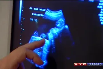 Otkrijte spol djeteta već u 7. tjednu trudnoće