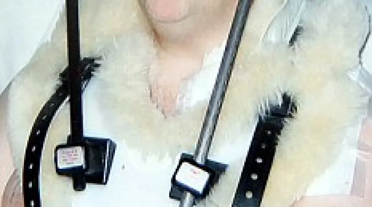 Pet mjeseci živio sa slomljenim vratom