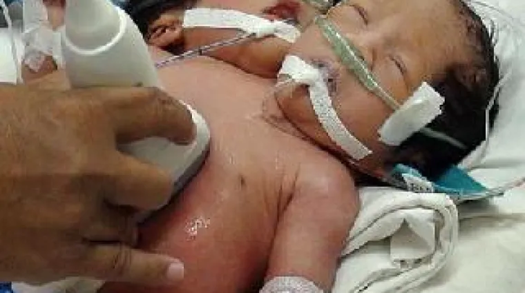 Najteža odluka: Samo jedna kćer će preživjeti