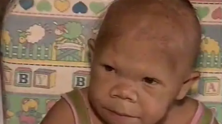 Trideset joj je godina, a izgleda poput bebe