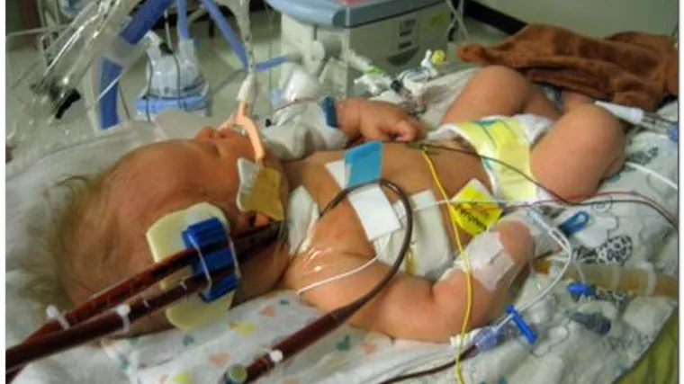 Silovali bebu i polomili joj sve kosti u tijelu