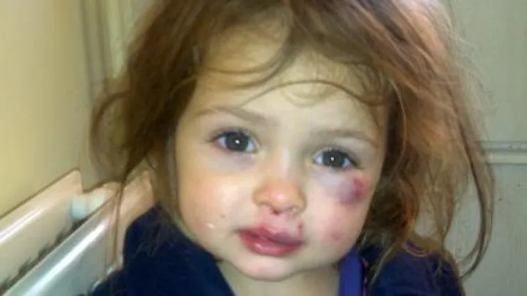 Dvogodi&scaron;njakinja divljački pretukla prijateljicu