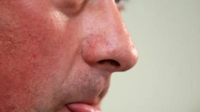 Polančec se opet izvukao