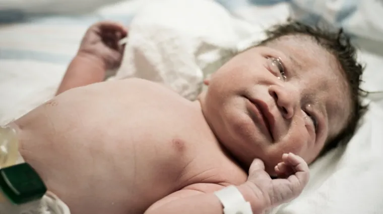 Spasili bebu rođenu bez kapljice krvi u tijelu!