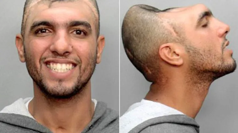 Potresna ispovijest čovjeka koji je ostao bez pola glave