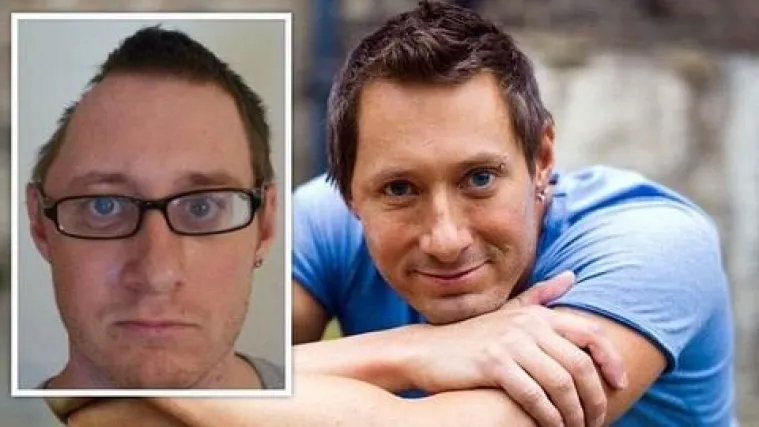 Čovjeku s pola lubanje uspjeli oblikovati glavu!