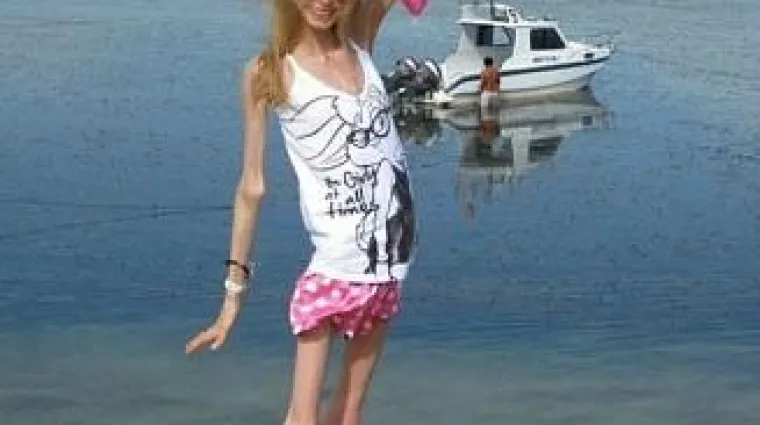 Izmislila vlastitu dijetu koja ju je dovela do ruba smrti!