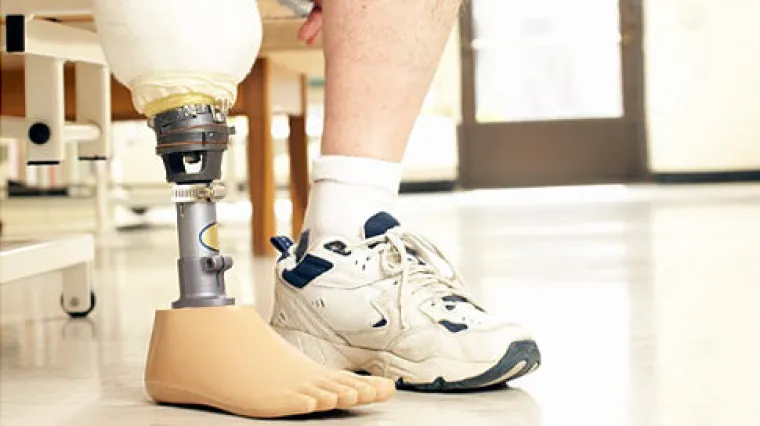 Otpilio si nogu da ne bi morao na posao