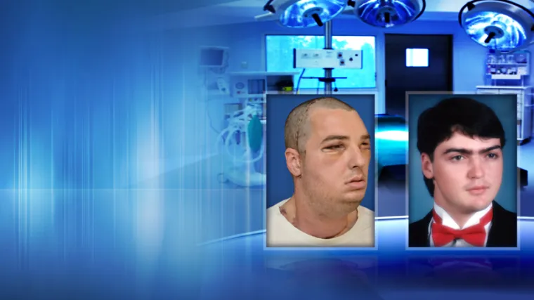 Čak 15 godina ga je skrivao, a sada ima novo lice!