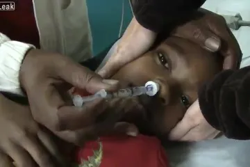 Kako je žohar dospio u uho ovog dječaka?