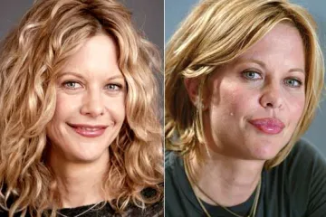 Ljepotice, što ti se dogodilo s licem?