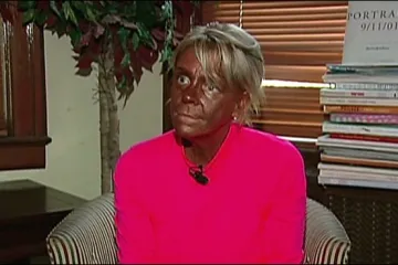 Majka ovisna o solariju odvela kćerkicu na 'kvarcanje'