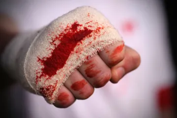 Horor u Splitu: Mladiću gulili kožu s glave!