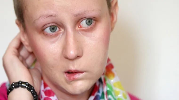 Pomozite mladoj Zagrepčanki u borbi za život