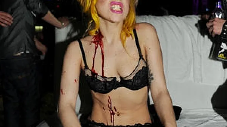 Pomahnitala Lady Gaga u krvi do koljena!