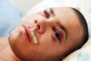 Redari Haciende brutalno pretukli mladića