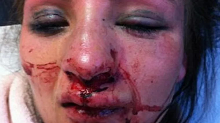 'Nemojte si dopustiti ovakvo zlostavljanje!'