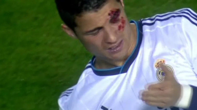 Ronaldu odmah razbili glavu, on im se osvetio