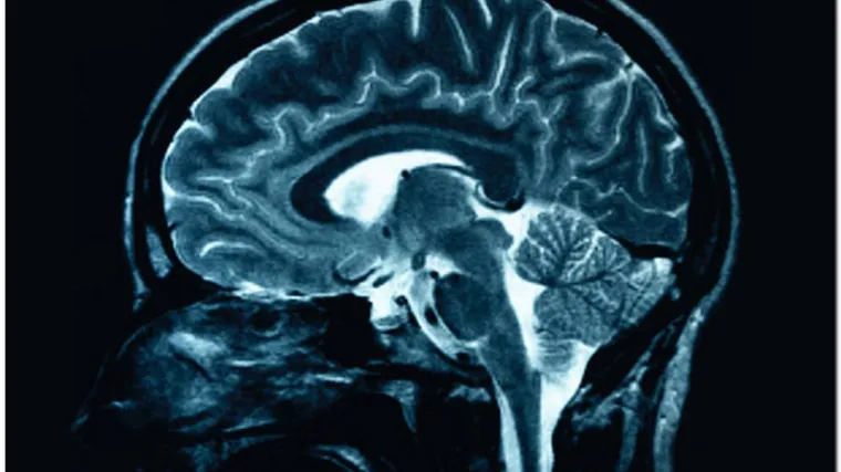 Liječnici uspjeli 'pročitati misli' pacijentu u komi!