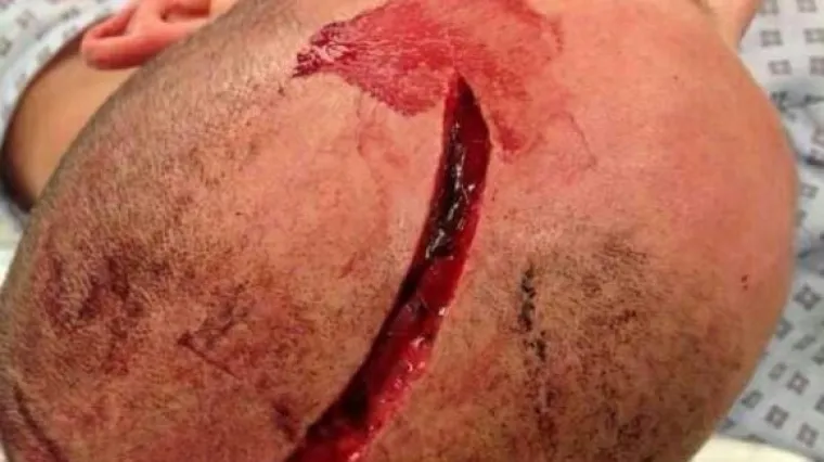 Strava i užas: Pogledajte &scaron;to su huligani napravili nesretnom Englezu