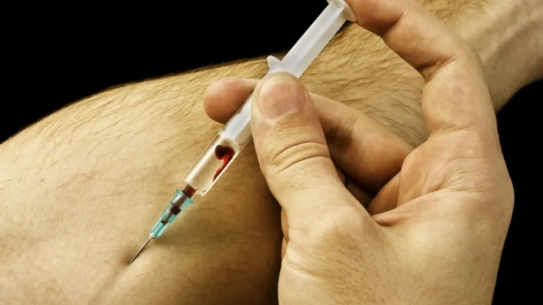 Vi&scaron;e od polovice ih niti ne zna da su zaraženi HIV-om!