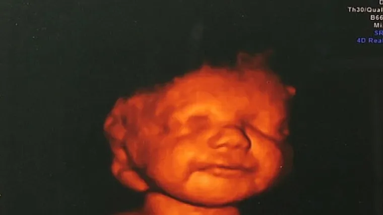 Nije mogla pobaciti pa bolesnoj bebi omogućila da umre u miru