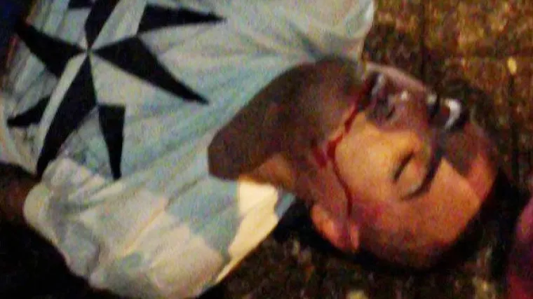 Uznemirujući video nokautirane nogometne zvijezde