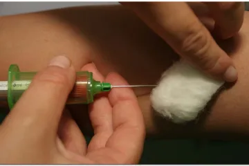 Djevojčicu u SAD-u izliječili od HIV-a!