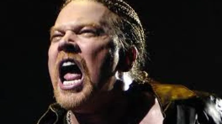 Axl Rose na koncertu izbio zube obožavatelju