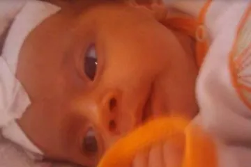 Pogoršalo se stanje bebe koja je ujedinila građane BiH!