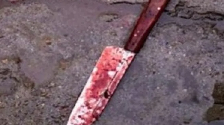 Uznemirujuće: Ruskinje odrubile glavu beskućniku