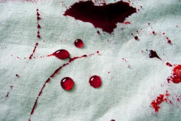 Gnjevna obitelj odsjekla mladoženji spolovilo i iščupala zube